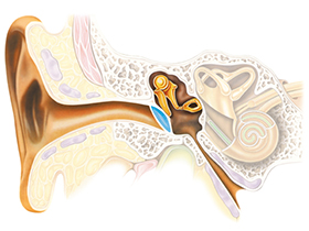 hearing_loss